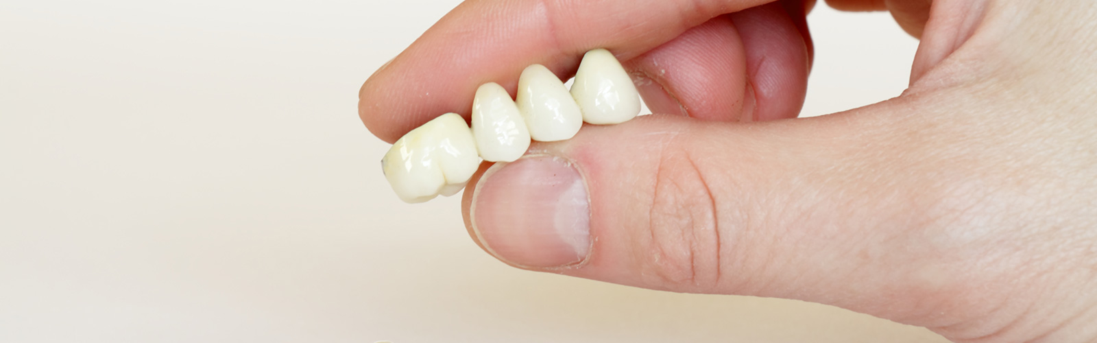 A hand holding a Dental Bridges over a white background.