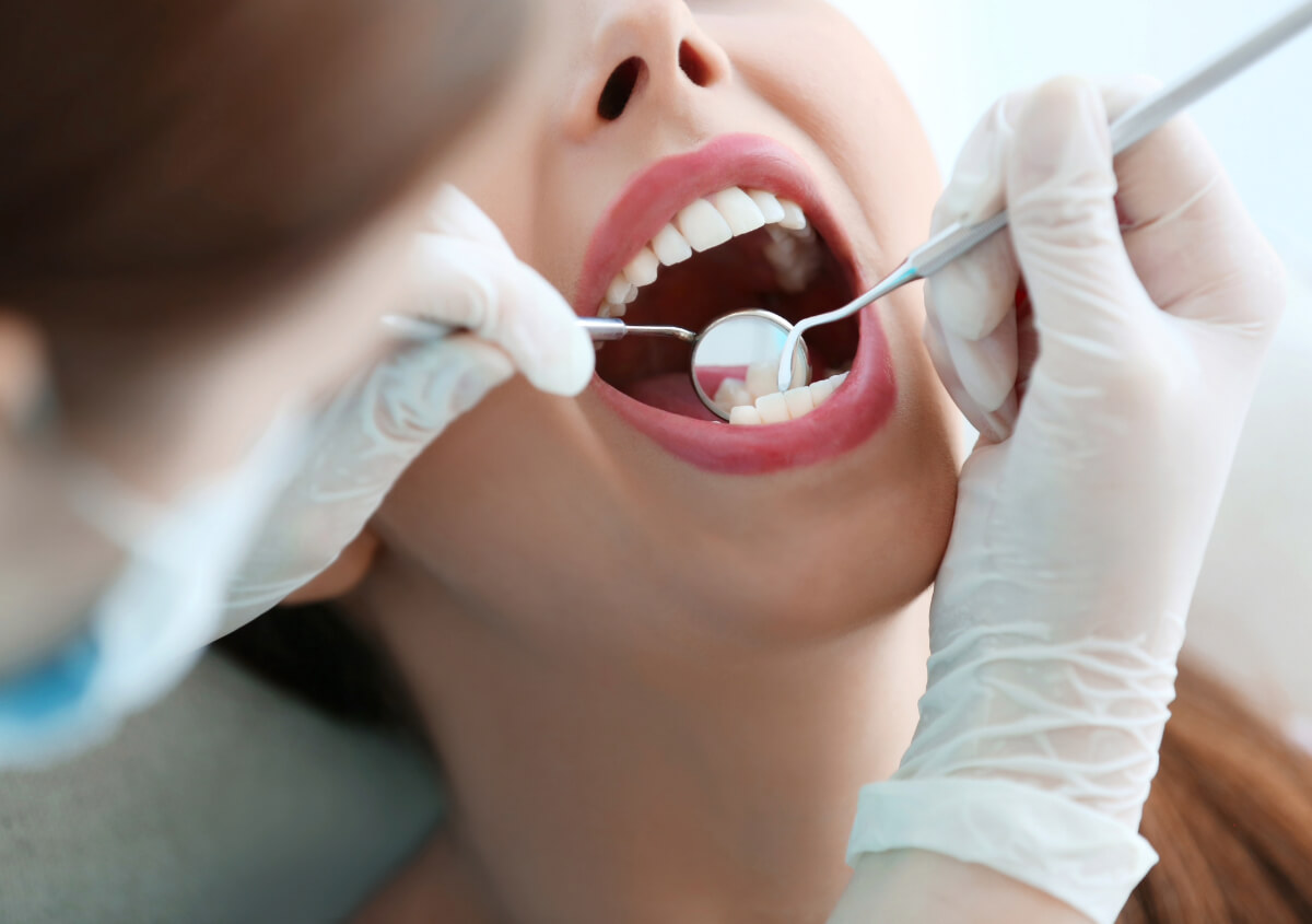 Professional Teeth Cleaning in Encinitas CA area